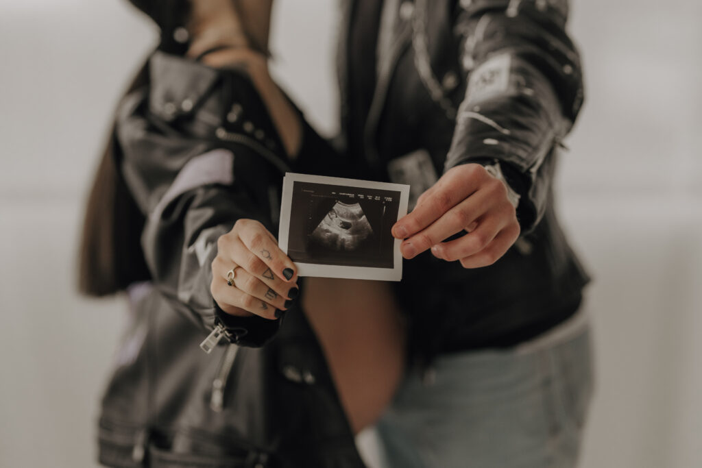 Babybauch Fotografie Portfolio Paar verschwommen im Hintergrund hält Ultraschallbild in die Kamera