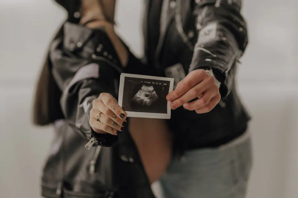 Babybauch Fotografie Portfolio Paar verschwommen im Hintergrund hält Ultraschallbild in die Kamera