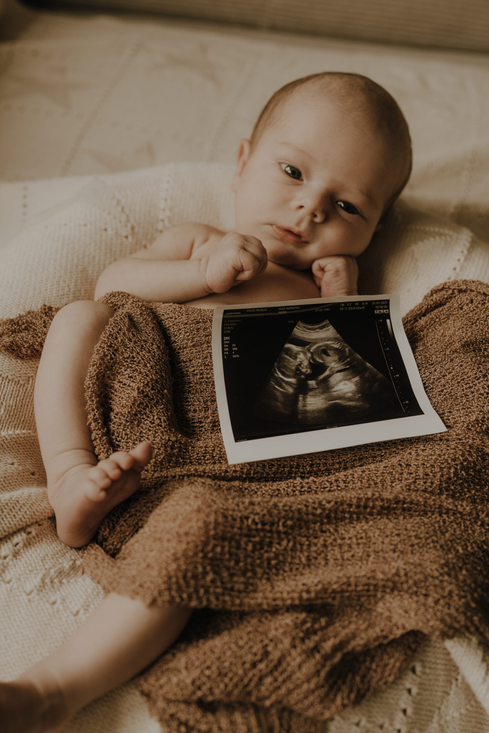 Newborn Portfolio Baby unter brauner Decke mit Ultraschallbild